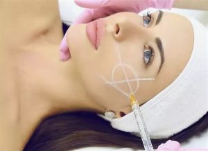 Филлеры Saypha: новая парадигма в эстетической медицины