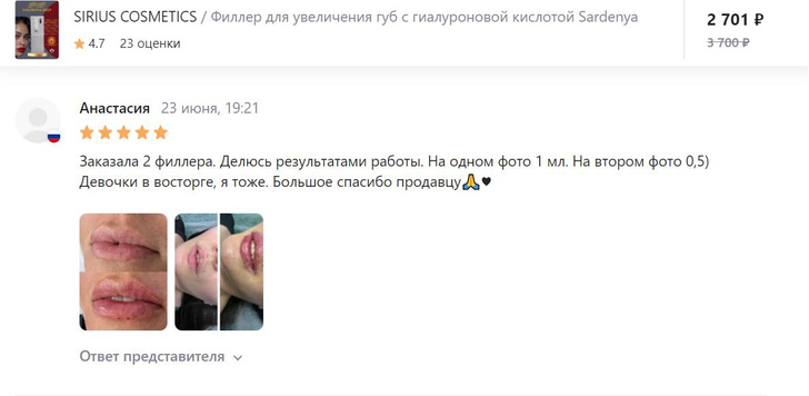 На маркетплейсах торгуют самодельными филлерами&nbsp;&mdash; эксперты в панике, это прямой путь к инвалидности