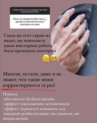 Зачем колоть в руки филлеры, как это делает Лена Перминова,&nbsp;&mdash; отвечает косметолог